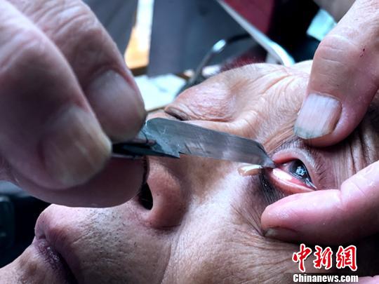 惊险又刺激的“刀锋洗眼”。　吕杨 摄