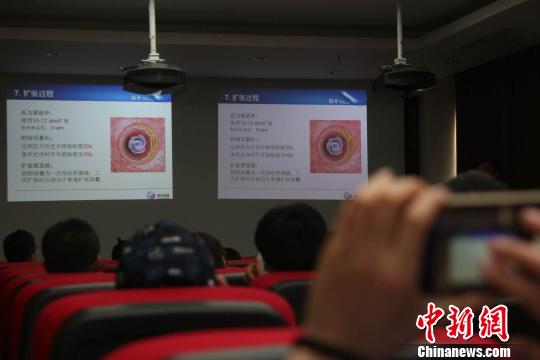 图为民众了解冠脉药物球囊“轻舟？药物球囊”的功效知识。　钟欣 摄