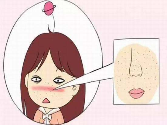 怎么才能告别“草莓鼻”变回小仙女？