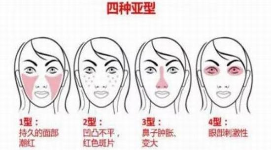 怎么才能告别“草莓鼻”变回小仙女？