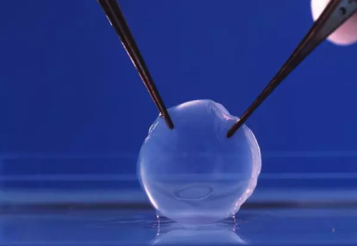 视力突然下降 为什么要移植角膜？