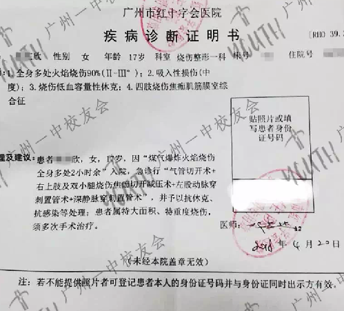 痛心!广州17岁少女洗澡时煤气爆炸 全身90%烧伤