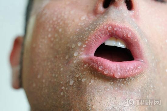 很容易出汗？暗示身体“故障”了！