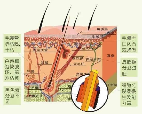 夏季是脱发高峰期 教你科学预防不掉发