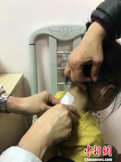 不同年龄的孩子贴敷时间不同。　芊烨 摄