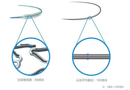 “火鹰支架”壁的凹槽与头发直径对比图