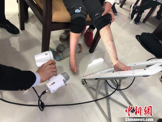 甘肃救助孤残疾独症儿童人工耳蜗植入费不低于7.2万元