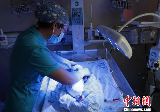 医护人员对黄疸患儿进行护理。　杨迪 摄
